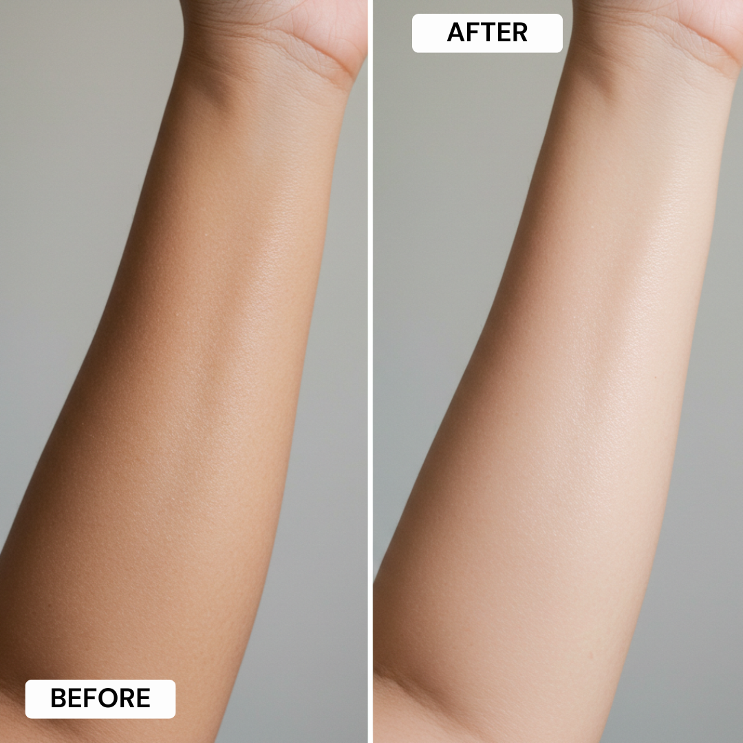 Before After Comparison 4